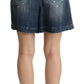 Chic High-Waisted Distressed Bermuda Shorts